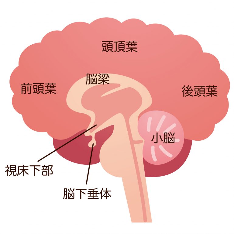 非機能性下垂体腺腫